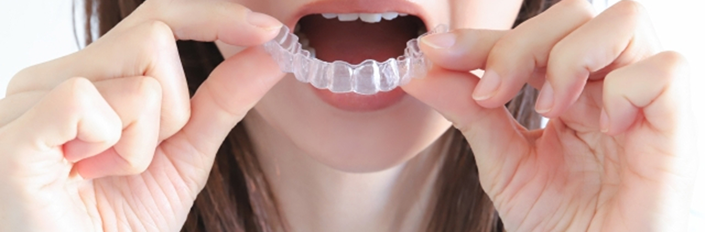 マウスピース矯正