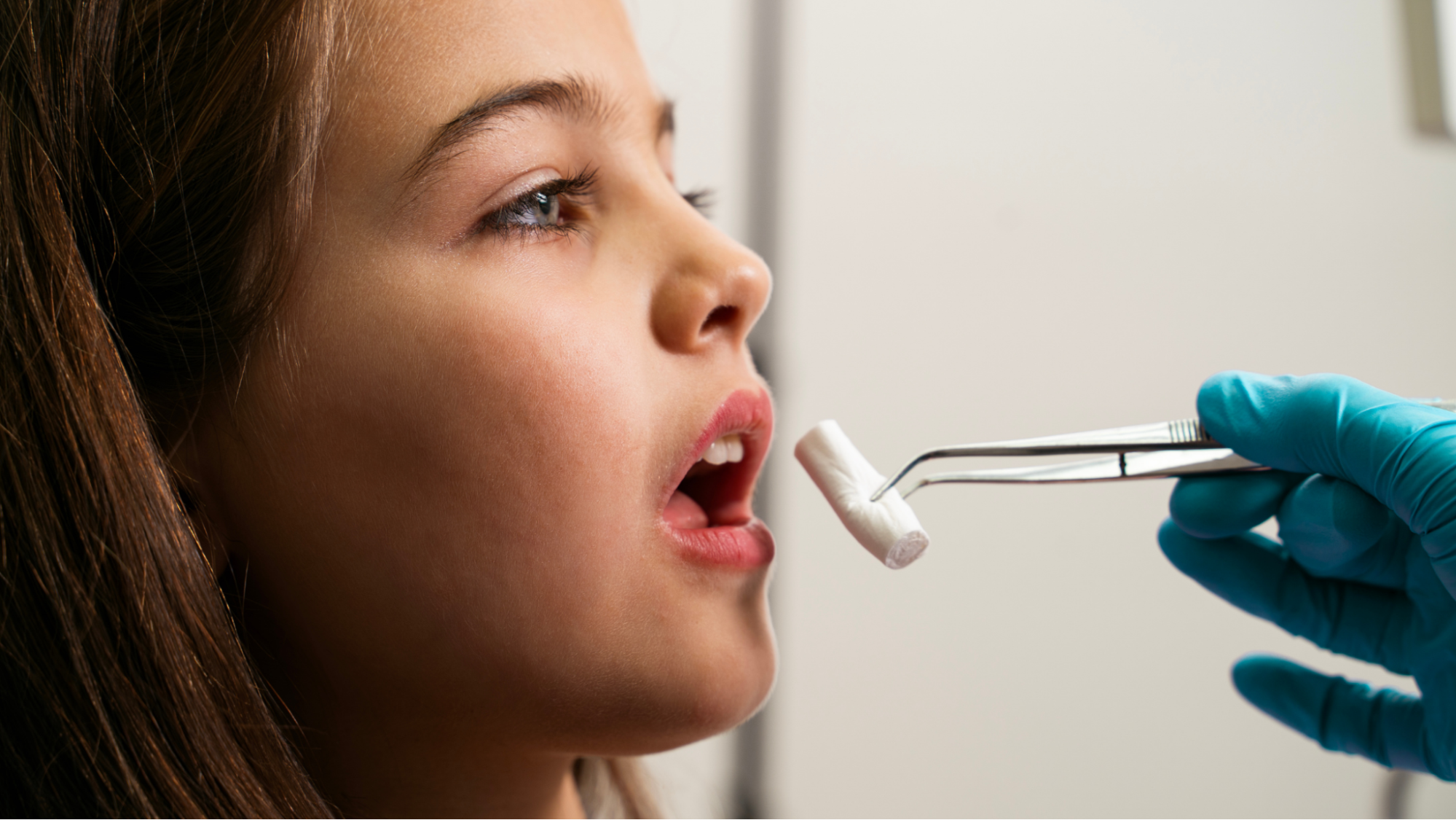 歯列矯正 高校生