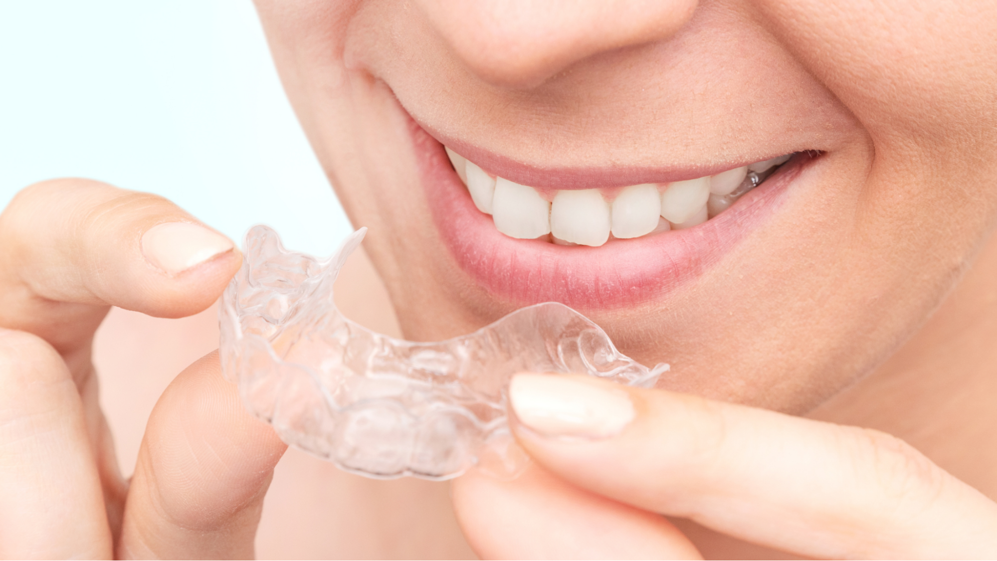 歯列矯正 高校生